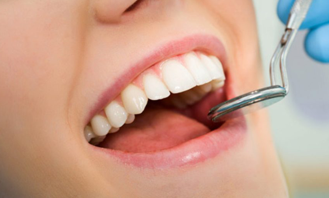 IMPLANTE DENTAL