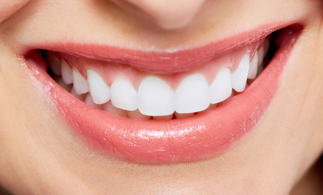 IMPLANTE DENTAL