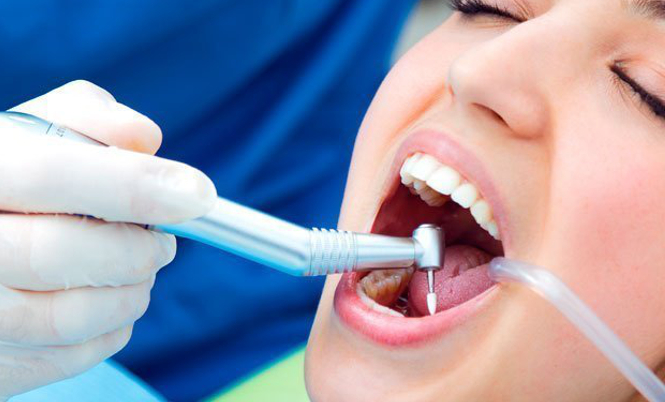 IMPLANTE DENTAL